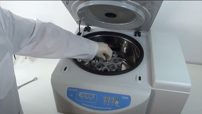 Solusi Masalah Umum pada Refrigerated Centrifuge di Laboratorium