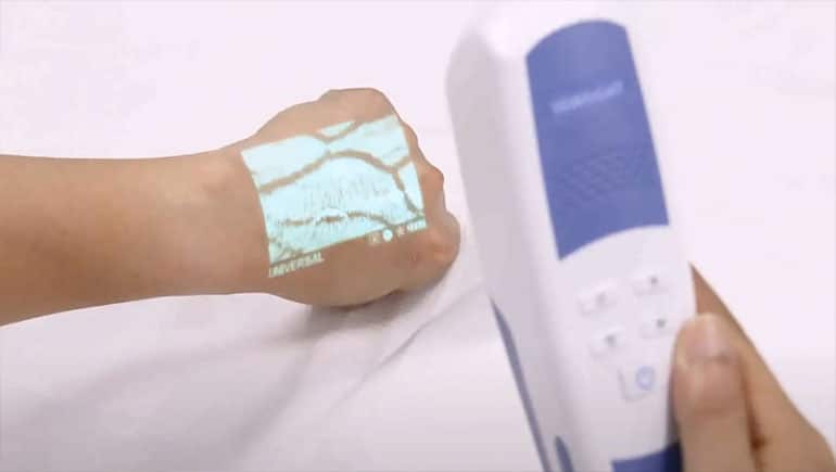 Cara Kerja Vein Finder AR (Augmented Reality)