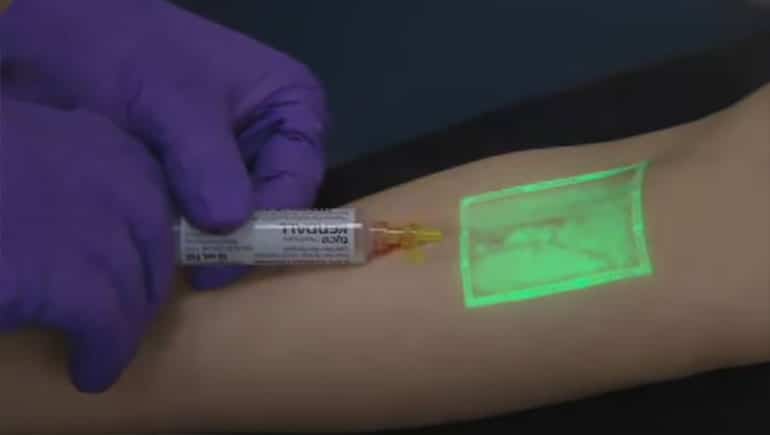 Keuntungan Penggunaan Vein Finder dalam Pemeriksaan Darah