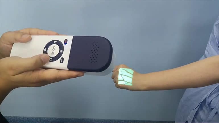 Memahami Vein Finder Inframerah Dan Kegunaannya