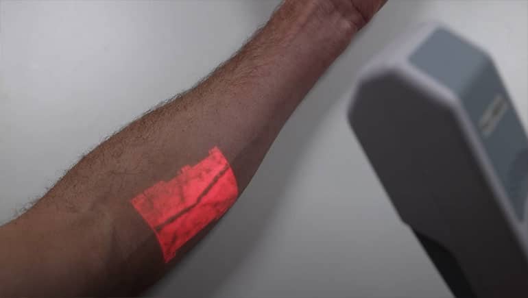 Penggunaan Alat Vein Finder dalam Pemberian Obat Melalui Injeksi Intravena